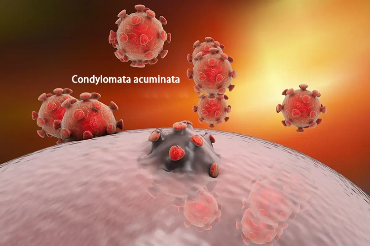 Pathogens of genital warts.