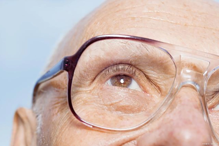 A cataract patient is looking at the sky with glasses.