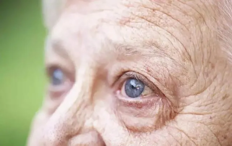 An elderly man with cataracts is looking into the distance.