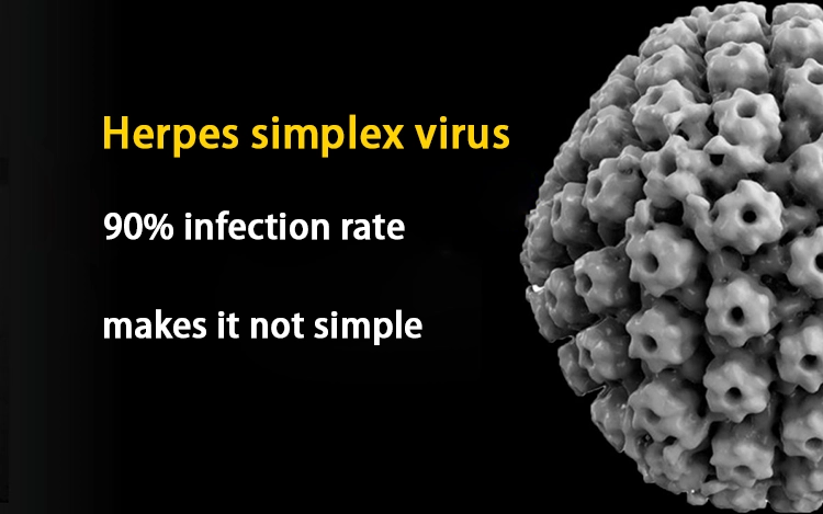 Herpes simplex virus.