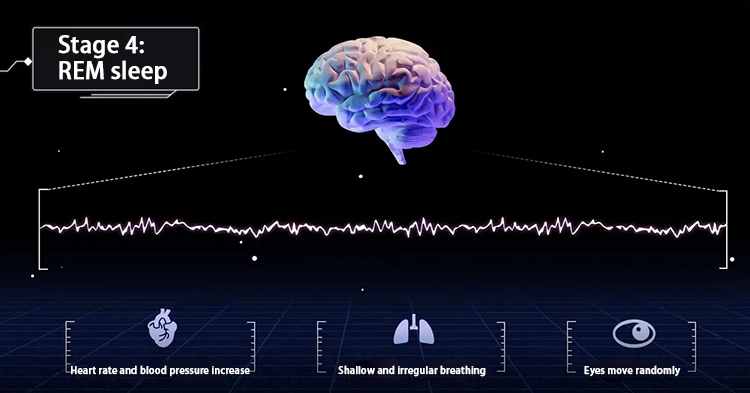 Stage 4: REM sleep.
